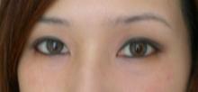 greyeye
