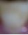 歯