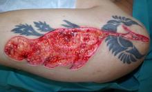 刺青