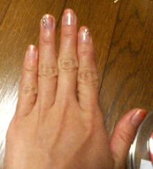 nail