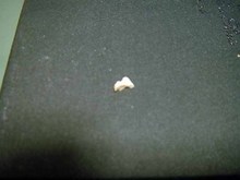 tooth