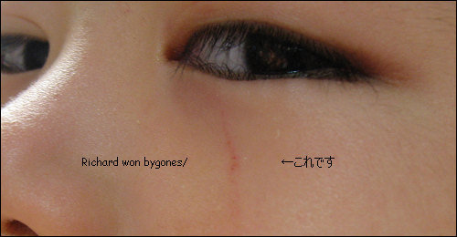 怪我
