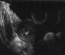5w