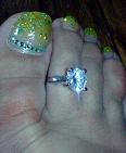 toe ring