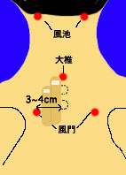 風池と風門