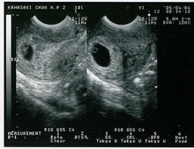 6W