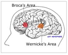 wernicke