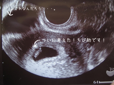 とぼけた旦那と出産待ちの日々-心拍確認