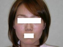 美容整形をトータルサポートする～Joe Clinic～院長ブログ