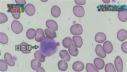 サイエンスZERO 病気になる前に治す！血中“極小物質”の謎