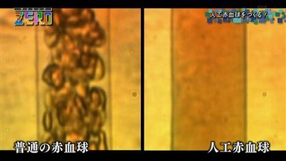 サイエンスZERO 「人工赤血球」 本物の血液よりも優れた点とは？